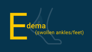 Edema in yellow text on blue background with ankle icon, representing that swollen ankles are a symptom of aortic stenosis