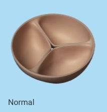 A model of a normal aortic valve of the heart